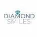 Diamond Smile Avis