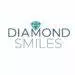Diamond Smile Avis
